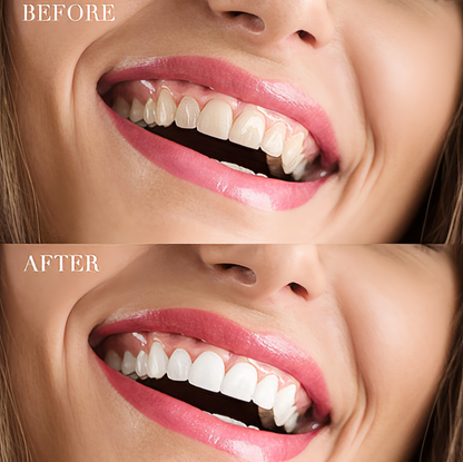 Blanqueador Dental Carbón Activado 60ml | Polvo Blanqueador Teeth Whitening Deep Cleansing
