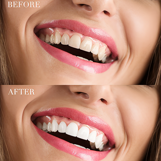 Blanqueador Dental Carbón Activado 60ml | Polvo Blanqueador Teeth Whitening Deep Cleansing